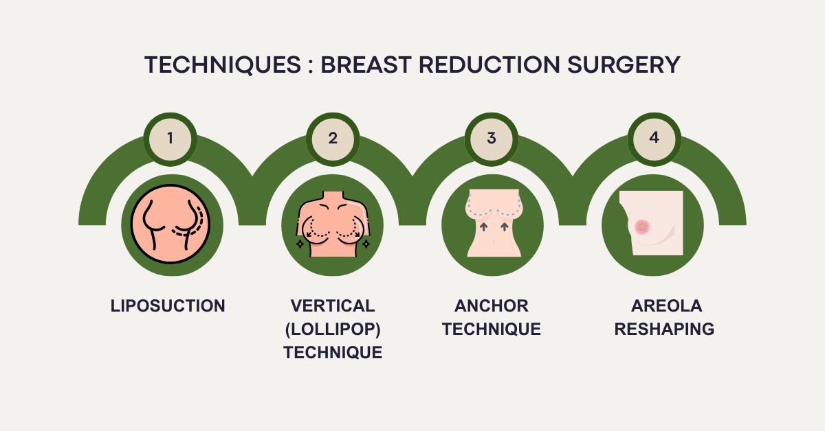 Techniques of breast reduction surgery in Mumbai