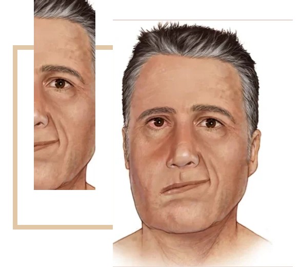 Head and Neck Reconstruction Mumbai