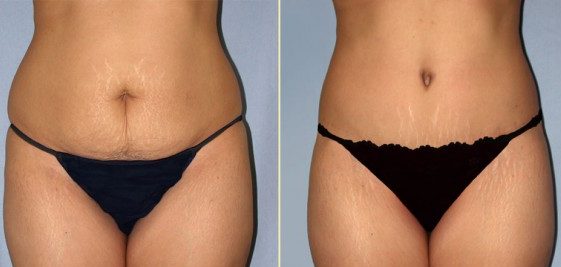 Special Considerations for Older Women