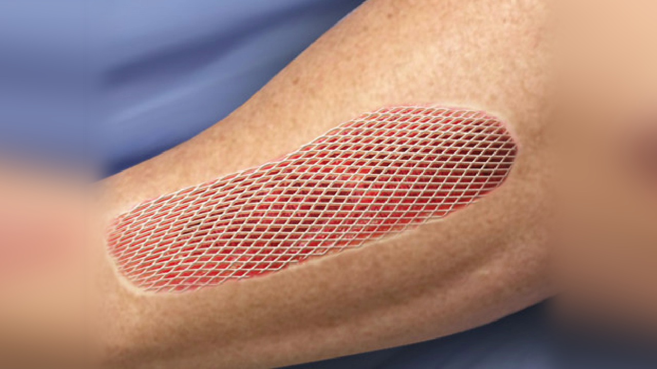 Post-Operative Care