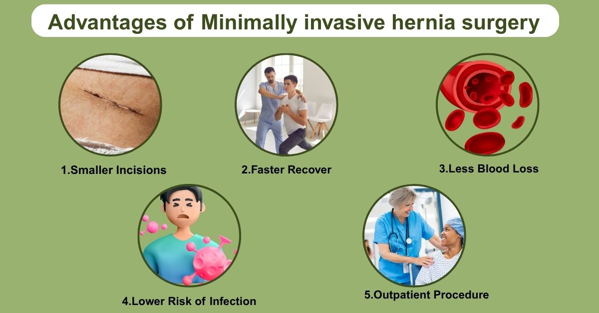 advantages of Minimally Invasive Abdominal Hernia Surgery in Mumbai by dr. Vinay Jacob