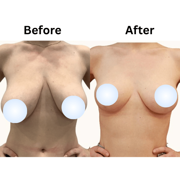 Recovery and Aftercare