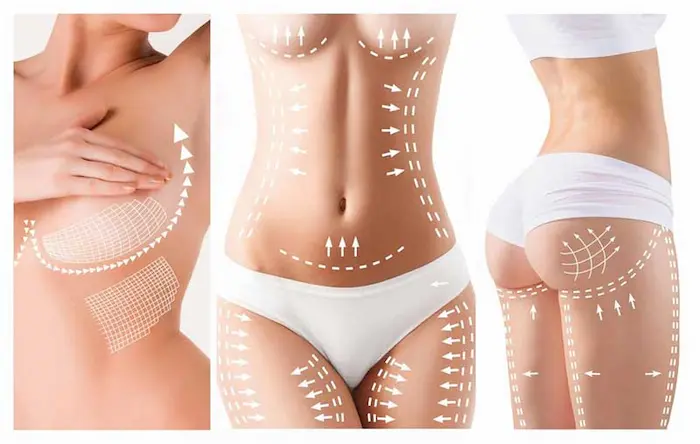 Body Lift Surgery Costs in Mumbai