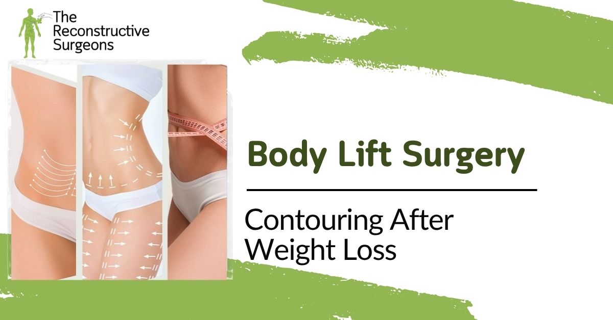 Body Lift Surgery in Mumbai Blog Image
