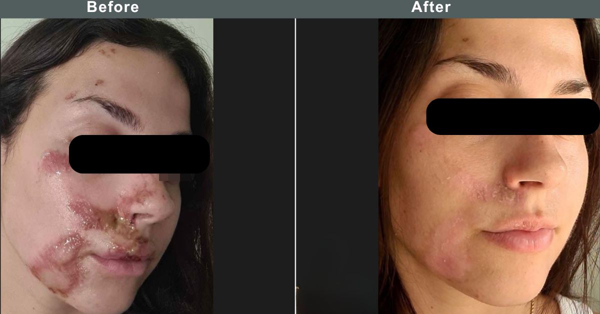 Choosing the Right Surgeon in Mumbai