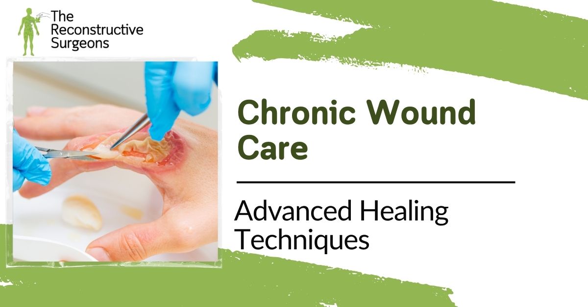 Chronic Wound Advanced Healing Techniques Blog Image