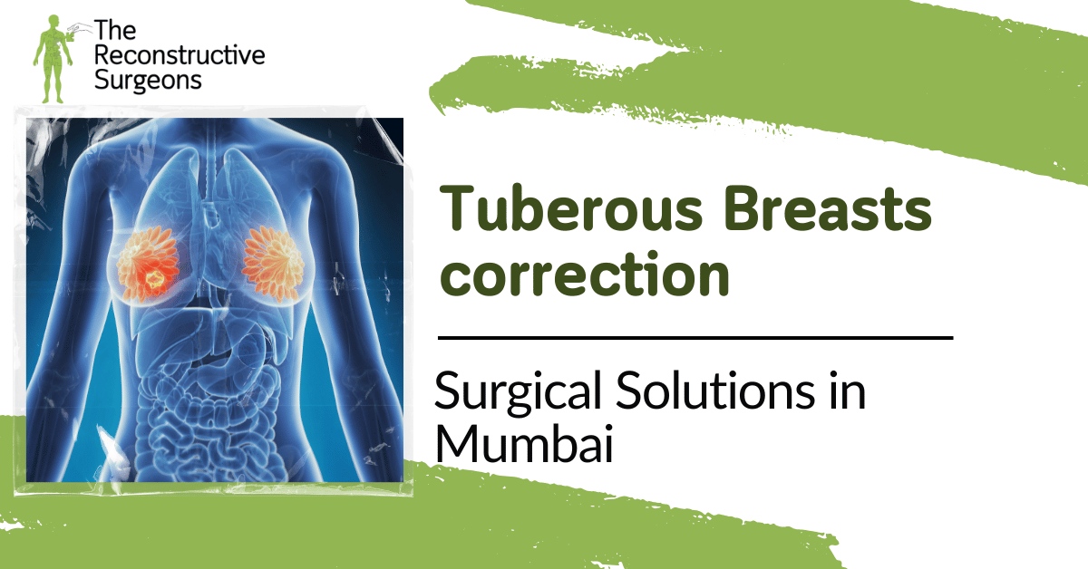 Correcting Tuberous Breasts Blog Image