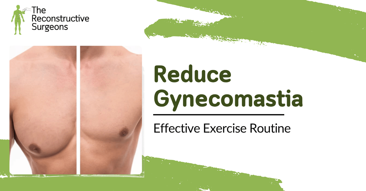 Effective Exercise Routine to Reduce Gynecomastia Naturally