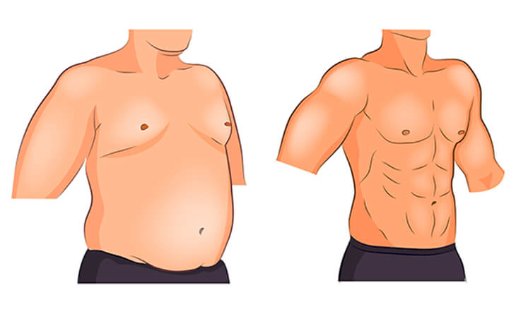 Effective Exercise Routine to Reduce Gynecomastia Naturally