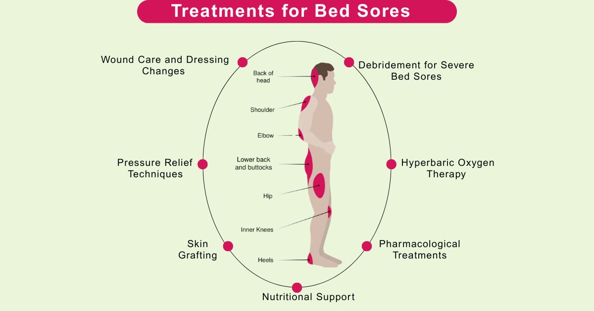 Effective Treatments for Bed Sores in Mumbai By Dr.Vinay jacob