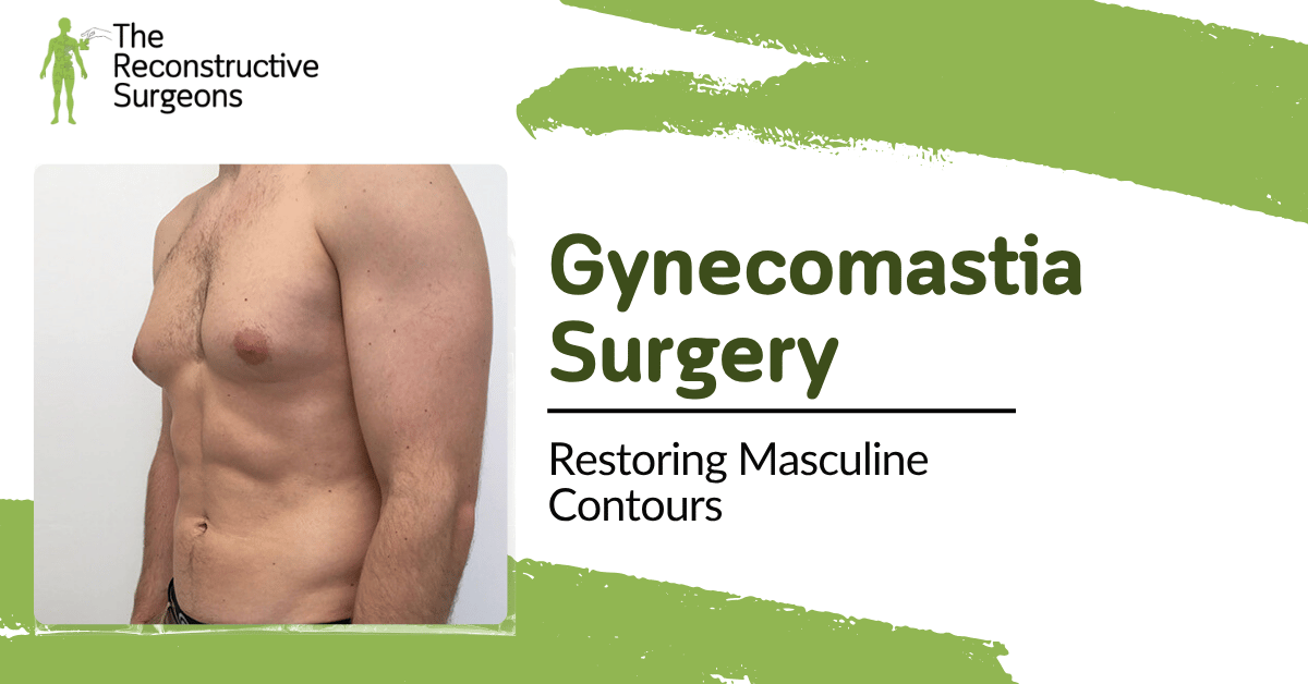 Gynecomastia Surgery Blog Image