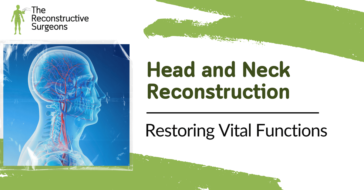 Head and Neck Reconstruction Blog Image