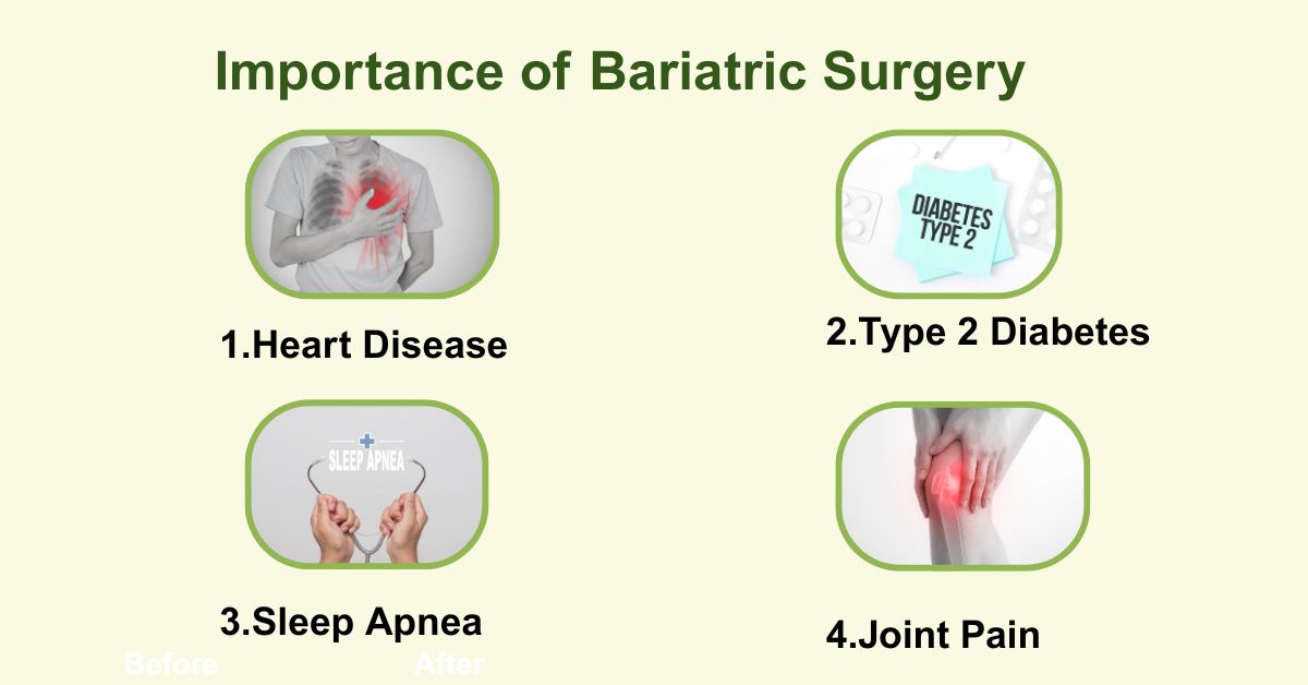understand Bariatric Surgery Importance in Mumbai with Dr. Vinay Jacob