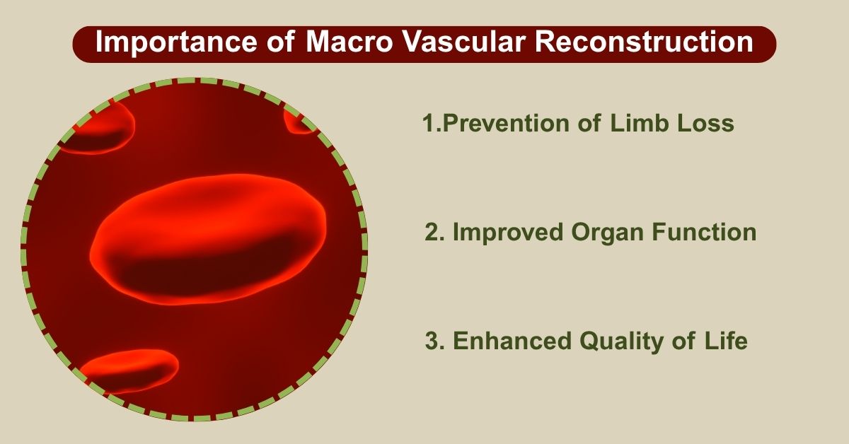 Learn Importance of Macro Vascular Reconstruction in Mumbai
