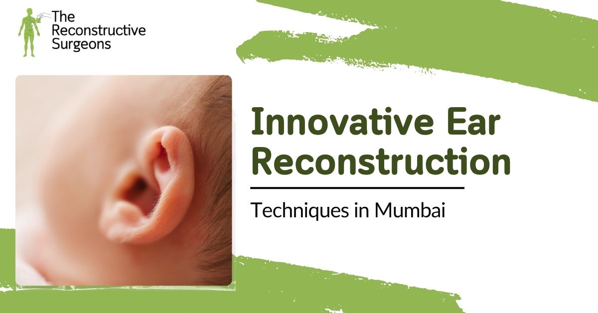 Ear Reconstruction innovative Techniques by Dr. Vinay Jacob