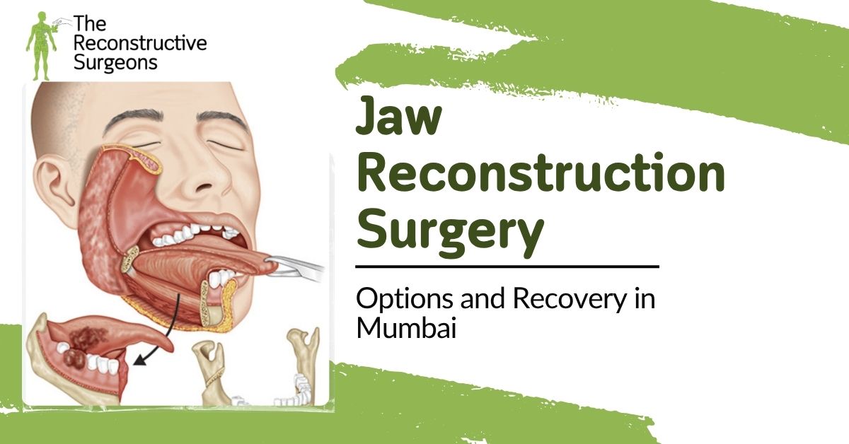 Jaw Reconstruction Options and Recovery in Mumbai