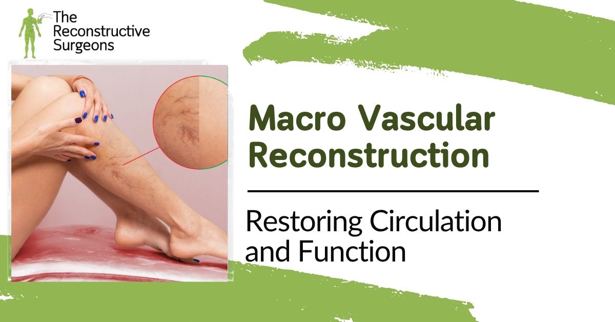 Macro Vascular Reconstruction in Mumbai Blog Image