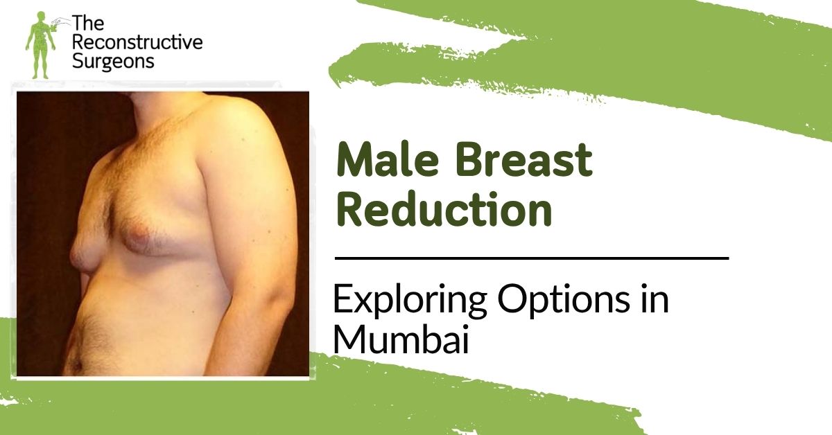 Exploring Male Breast Reduction Options in Mumbai