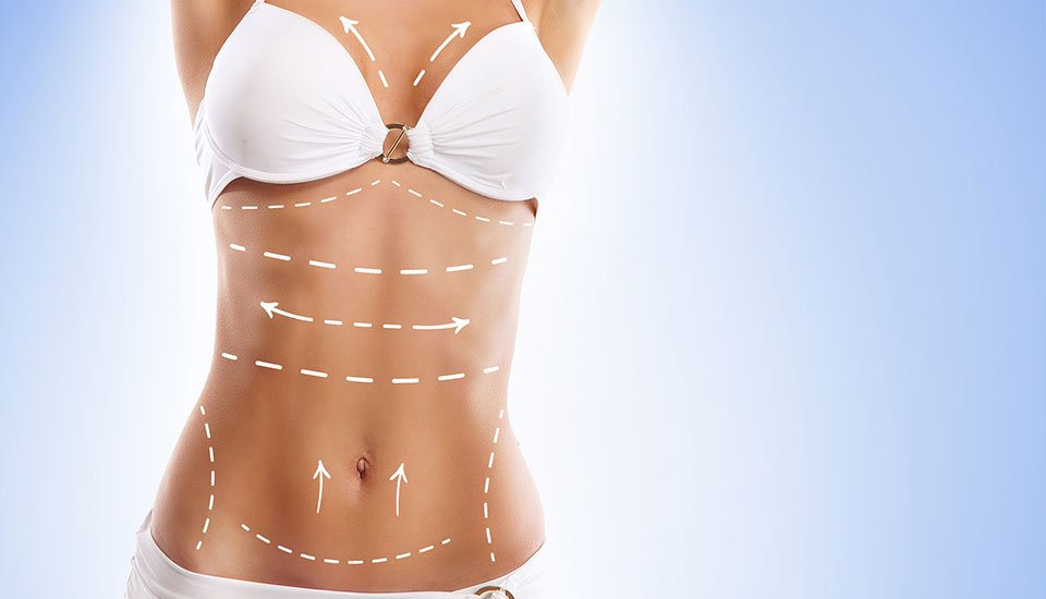 Planning Your Mommy Makeover Safely