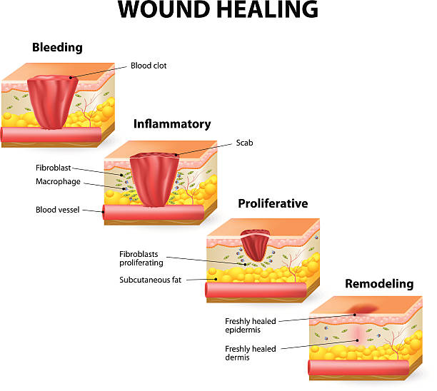 Nutritional support for wound healing in Mumbai by Dr. Jacob