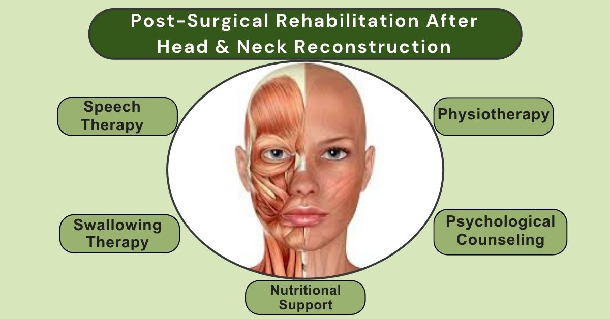 Post-Surgical Rehabilitation After Head & Neck Reconstruction