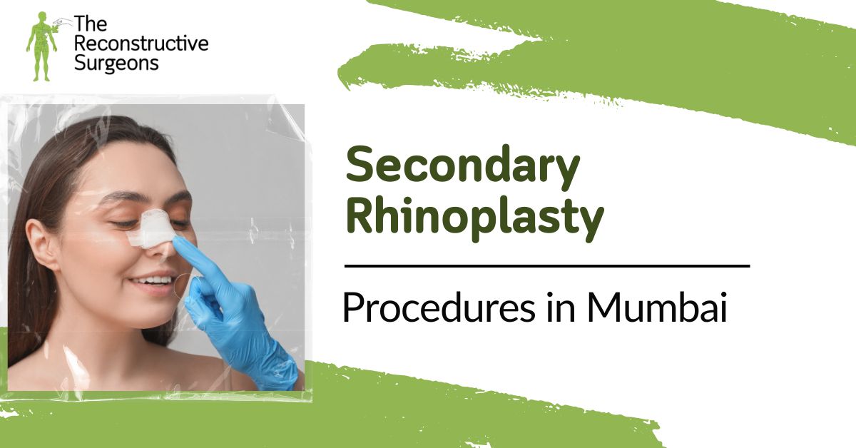 Understanding Secondary Rhinoplasty in Mumbai