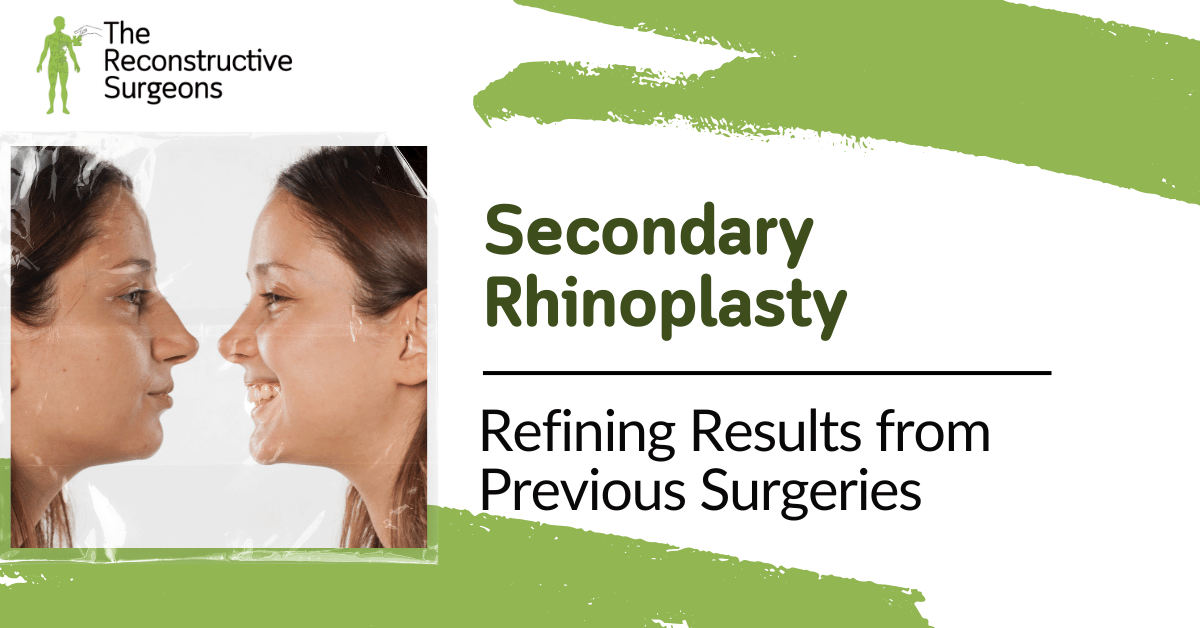 Secondary Rhinoplasty Blog Image
