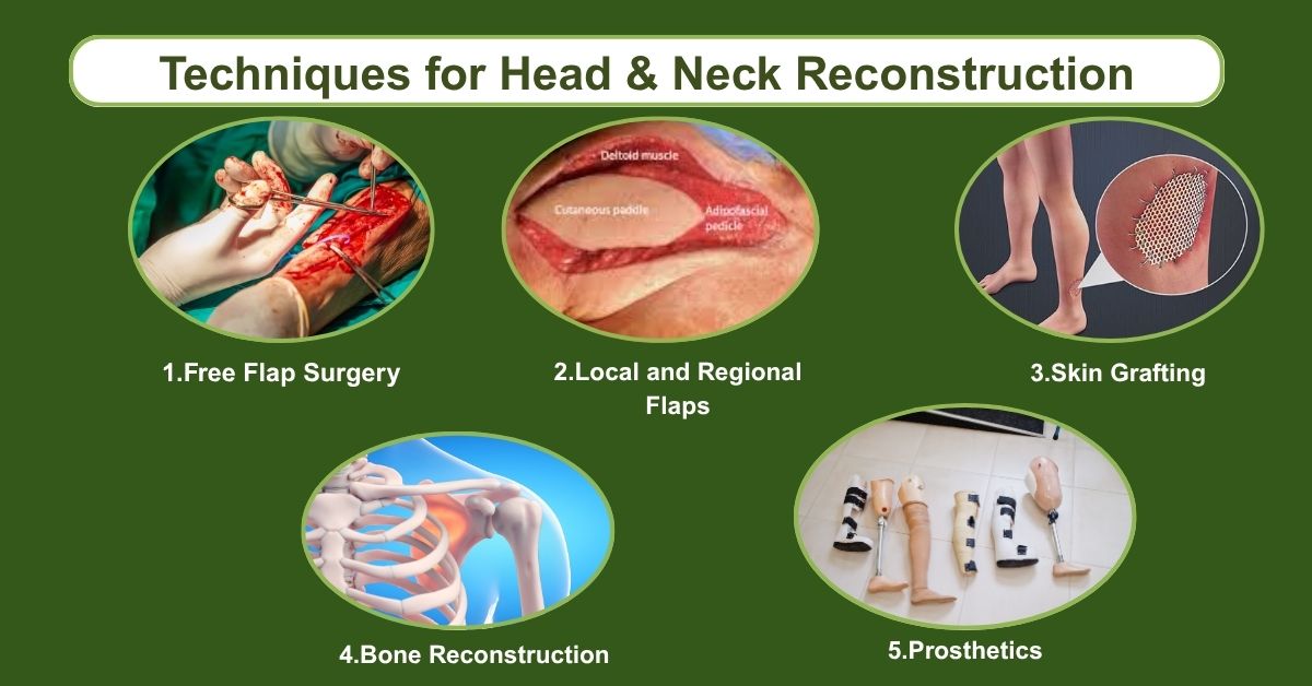 Surgical Techniques Used in Mumbai For Head and Neck Reconstruction