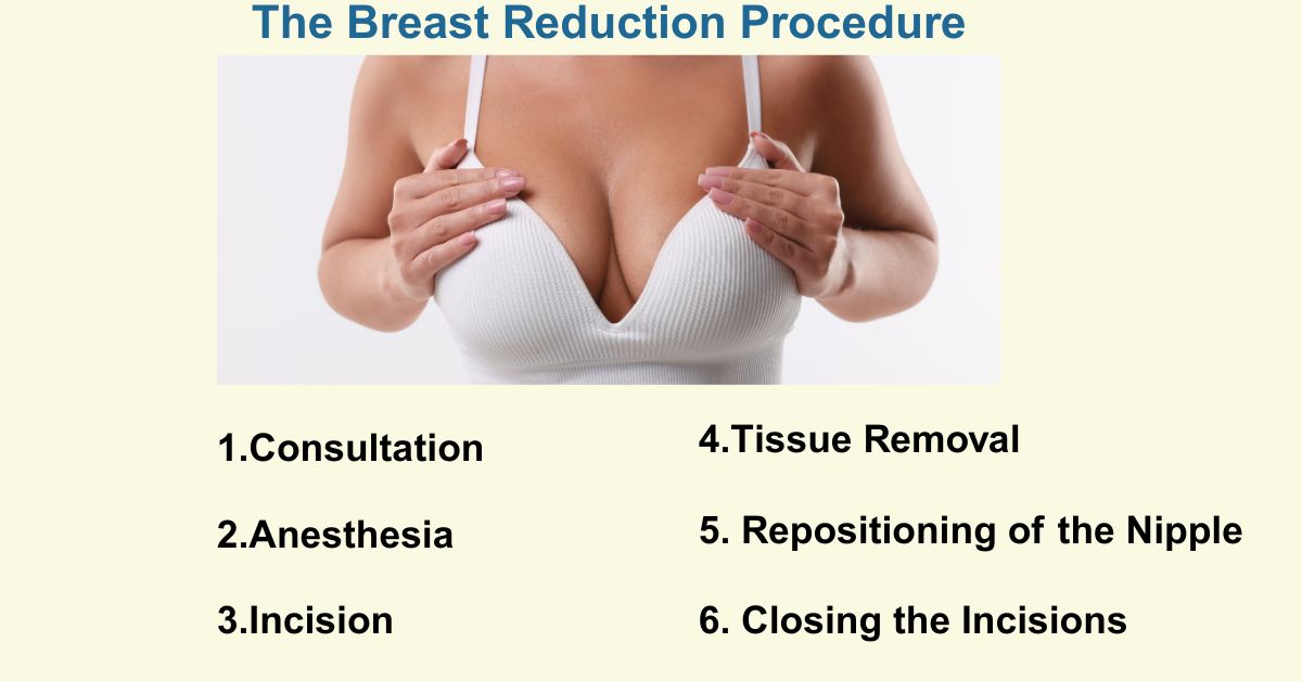 Breast Reduction Procedure