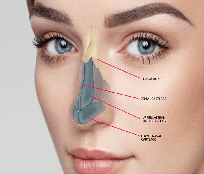 The Complexity of Secondary Rhinoplasty