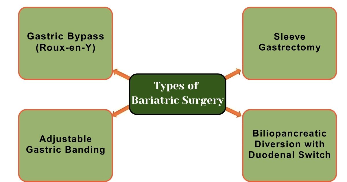 Learn Types of Bariatric Surgery in Mumbai with Dr. Vinay Jacob