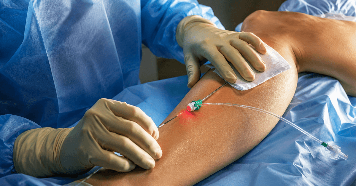 Vascular Reconstruction Surgery in Mumbai