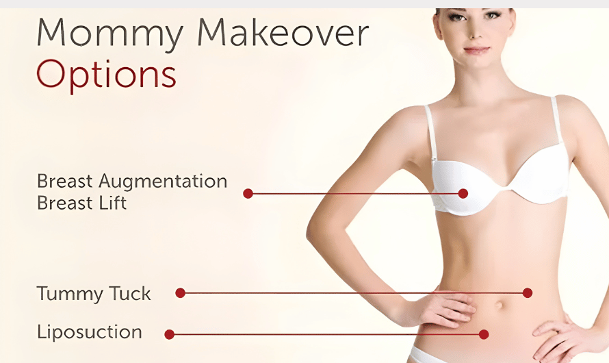 What a Mommy Makeover Means Today