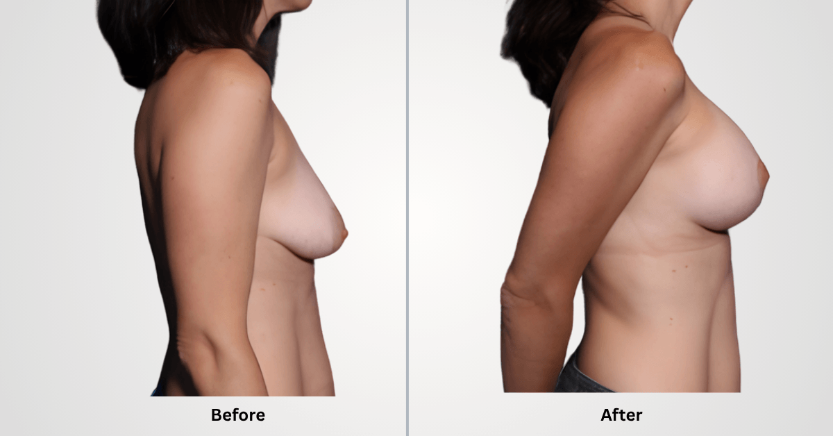 What Results Can You Expect