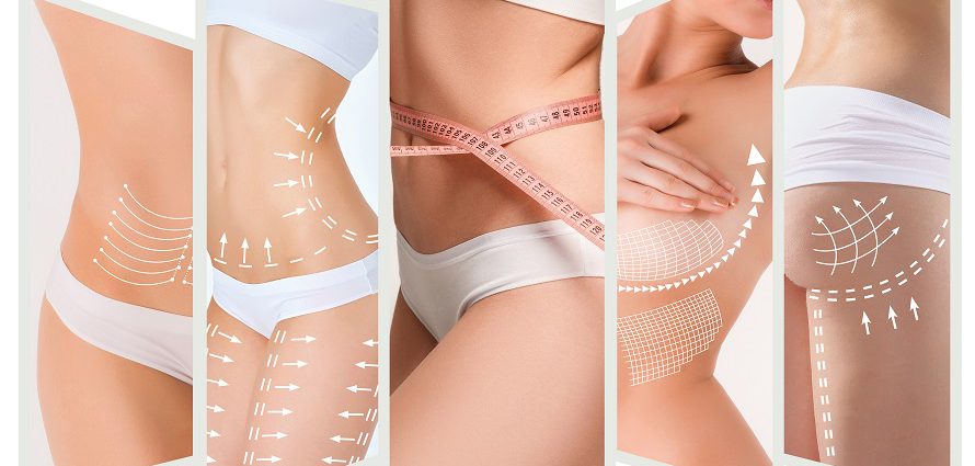 Learn Who is a Good Candidate for Body Lift Surgery in Mumbai with Dr. Vinay jacob