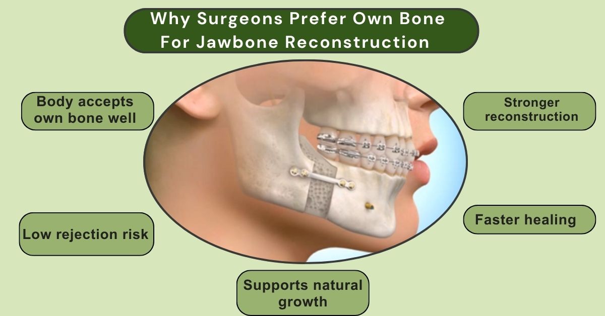 Why Surgeons Prefer Using Your Own Bone