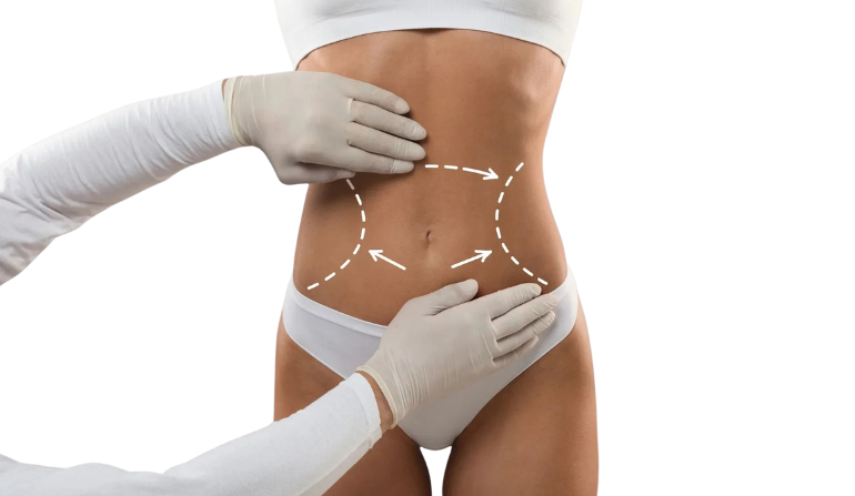 Body Contouring and Functional Repair