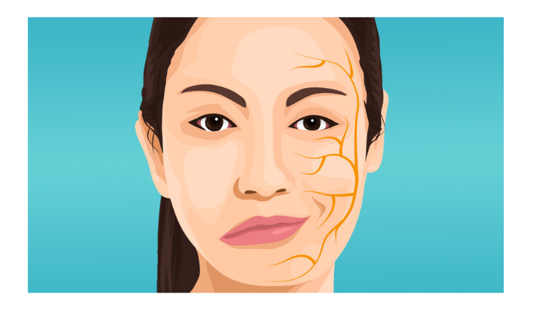 Facial Nerve Reconstruction