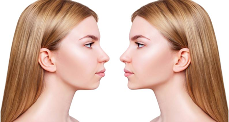 breast reconstructions