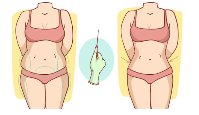 Mommy Makeover Surgery in Mumbai by Dr. Vinay Jacob at the Reconstructive Surgeons